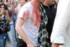 Pattinson in Brooklyn sporting fake blood, not fan blood